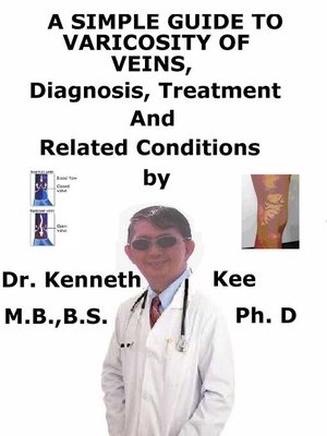 cover image of A Simple Guide to Varicosity of Veins, Diagnosis, Treatment and Related Conditions